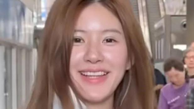 保质期太短？赵露思最新素颜照填充痕迹明显，离开精修油腻又浮肿