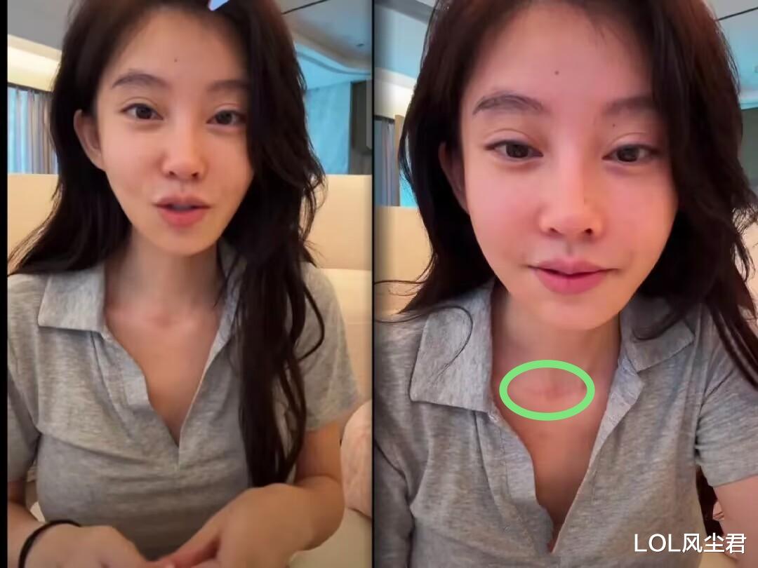 冯提莫首次素颜直播,面部状态判若两人,观众:脖子上的是草莓?