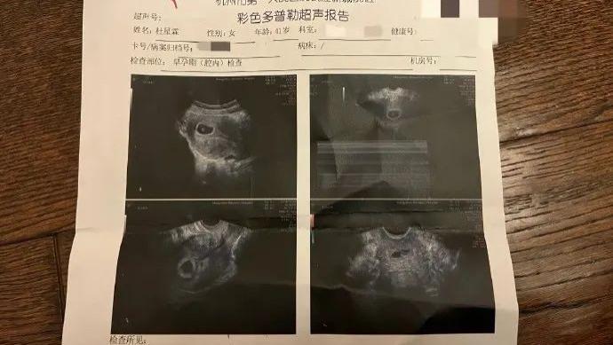 73岁张纪中再度当爸，杜星霖激动晒验孕棒，夫妻养生多年成效显著