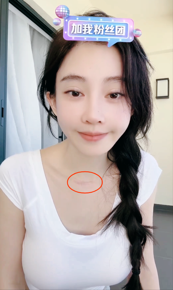 冯提莫展示身材被质疑生过孩子？冯提莫回复：我确实有一个孩子！