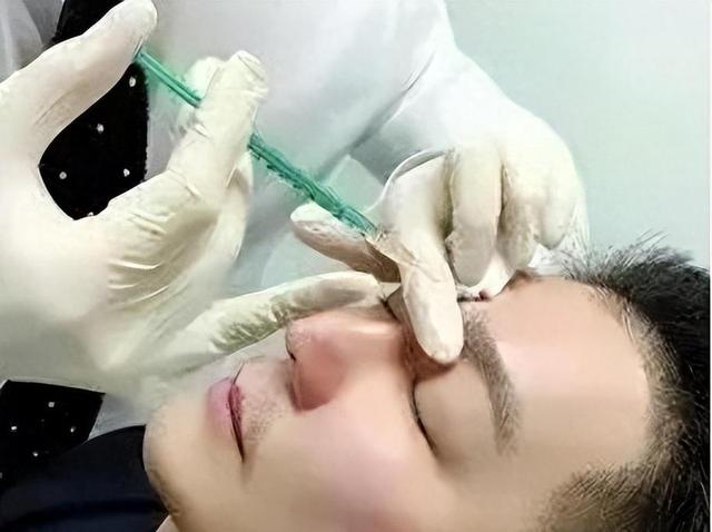 “宁愿丑成怪物”也要永葆青春，这8位明星早已整的“惨不忍睹”