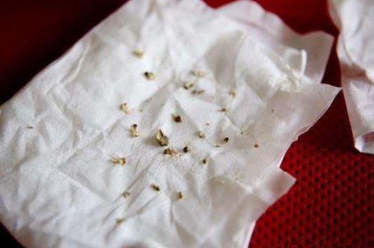 牙齿上长出“小石头”，味道又臭又硬，闻一下差点吐了