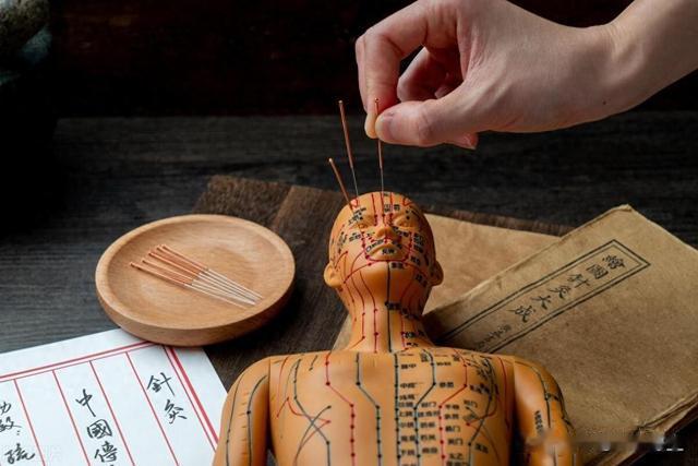 中医针灸的“绝技”——鬼门十三针，治急症和邪病，可惜快失传了