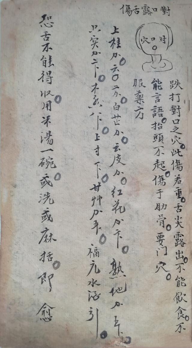 跌打损伤伤穴位秘方古书籍