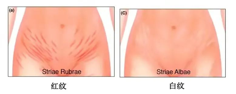 她别真是未婚先孕吧,顶着自毁前程的风险也要和渣男闪电完婚