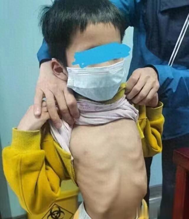 伤脾胃“最狠”的5种早餐，小心孩子越吃越矮小，赶紧停下！