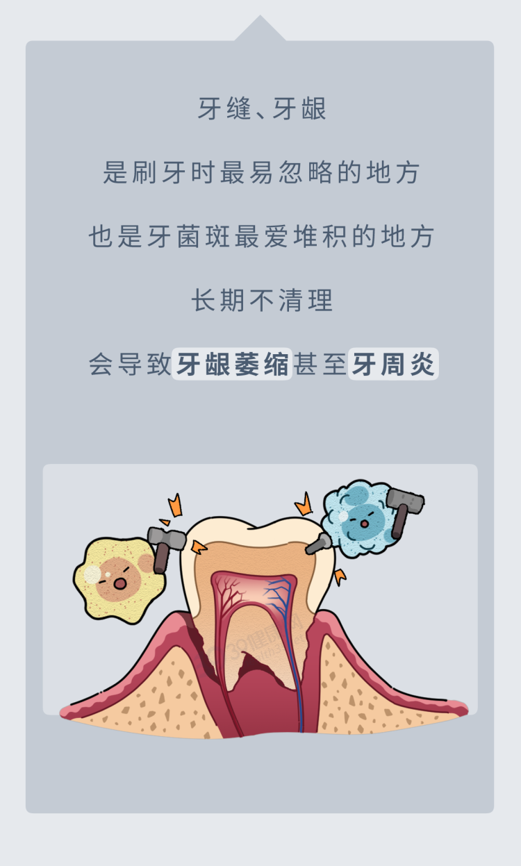 刷牙影响寿命？50万人研究：经常不刷牙的人，死亡风险增加25%