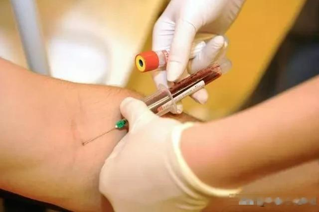 脚上一旦出现这种现象,是在提醒你:有血栓了,及时检查制止