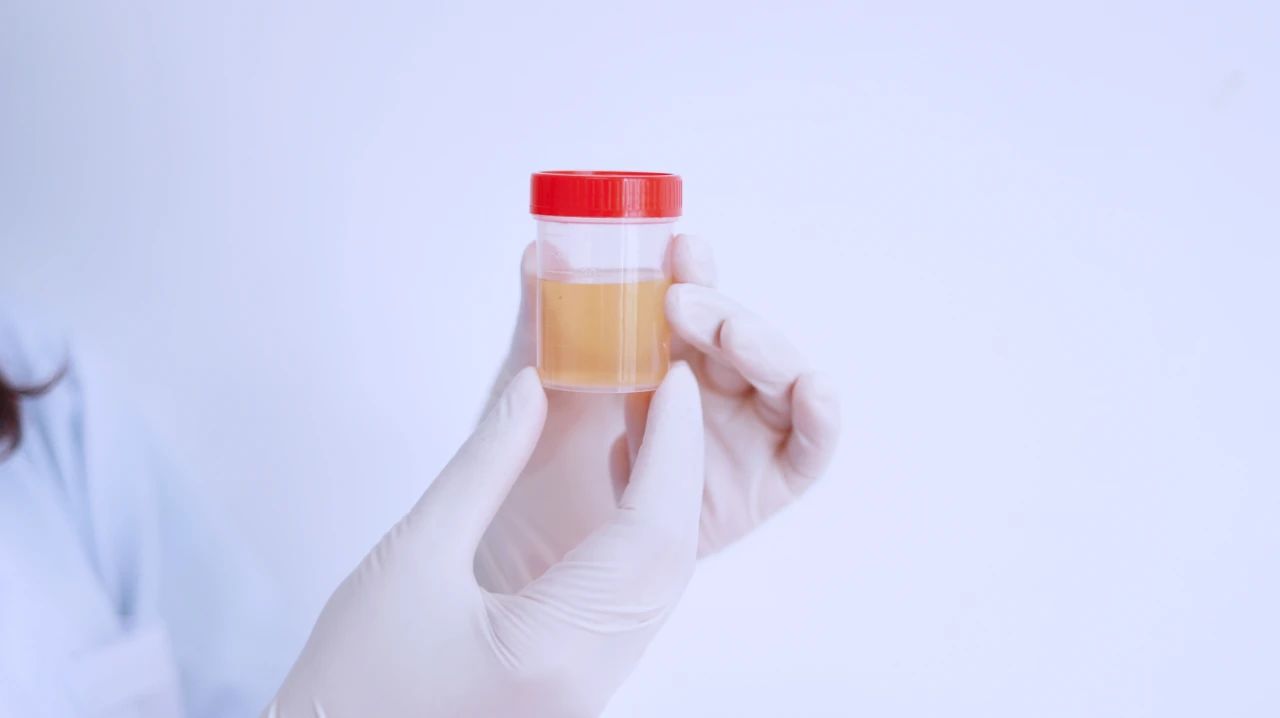 糖尿病患者总是爱出汗？可能与相关并发症有关，得及早治疗