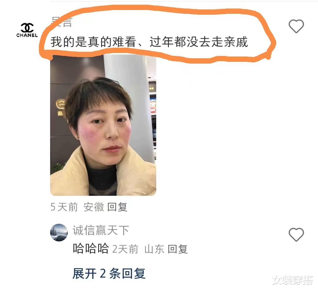 再也不理短发了!剪完就像狗啃的一样,大长脸顶个锅盖头,还显老