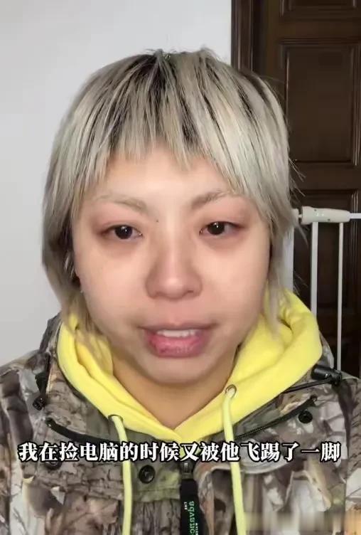 张大大拒向黄毛毛道歉一句话惹众怒资本家别再热捧表里不一的人了