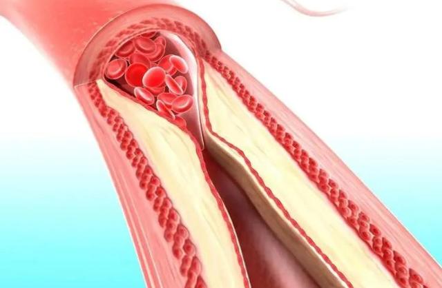 男性若坚持喝黄芪水，一个月后，4件“喜事”或不请自来