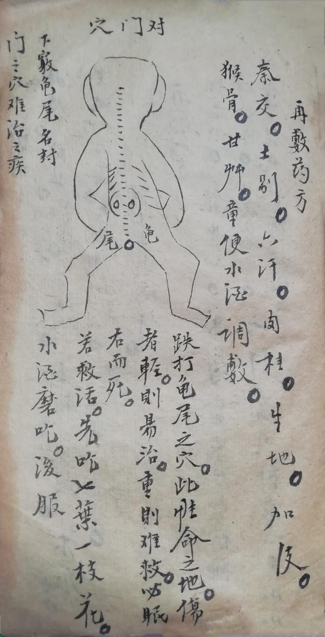 跌打损伤伤穴位秘方古书籍