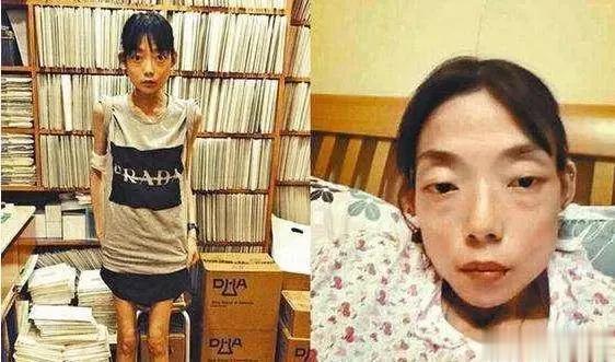 豪门玩物，几年被折磨成，不足80斤，似骷髅，惨不忍睹