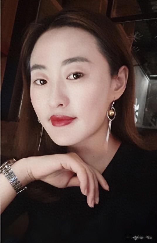 护肤常识:美容编辑分享去黑眼圈方法