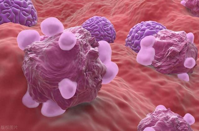 打一针预防肿瘤生长?我国研发出“癌症疫苗”,能消灭哪些癌症?