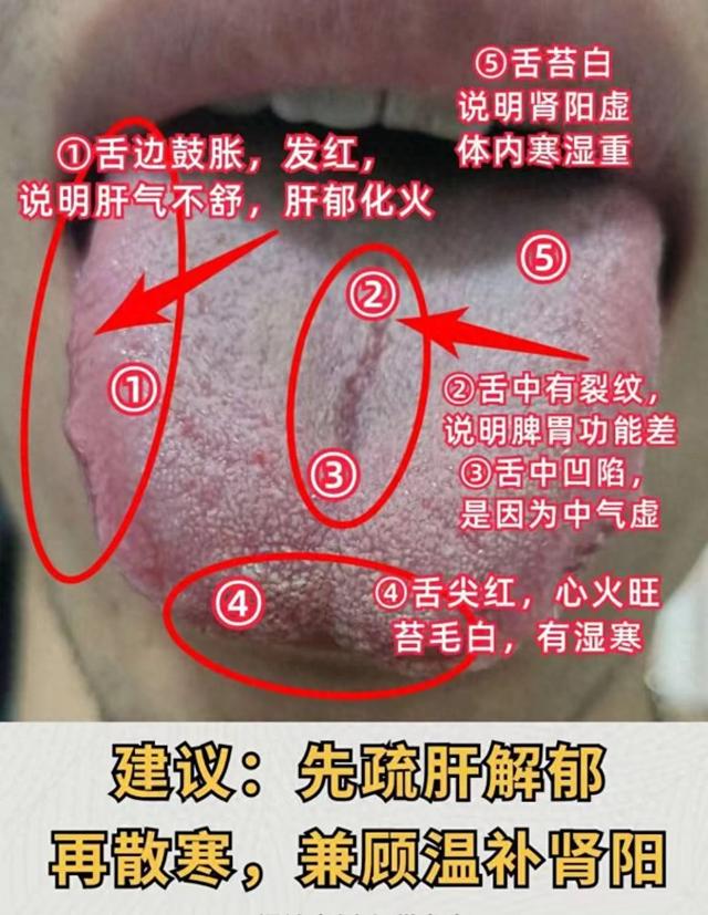 潘医生舌诊—实战分析：调理有顺序，这4大见舌象，看看有你吗？