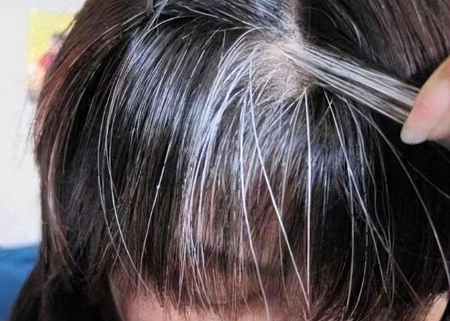 为啥白头发越长越多？你以为是老了，医生：或是缺乏2种营养素