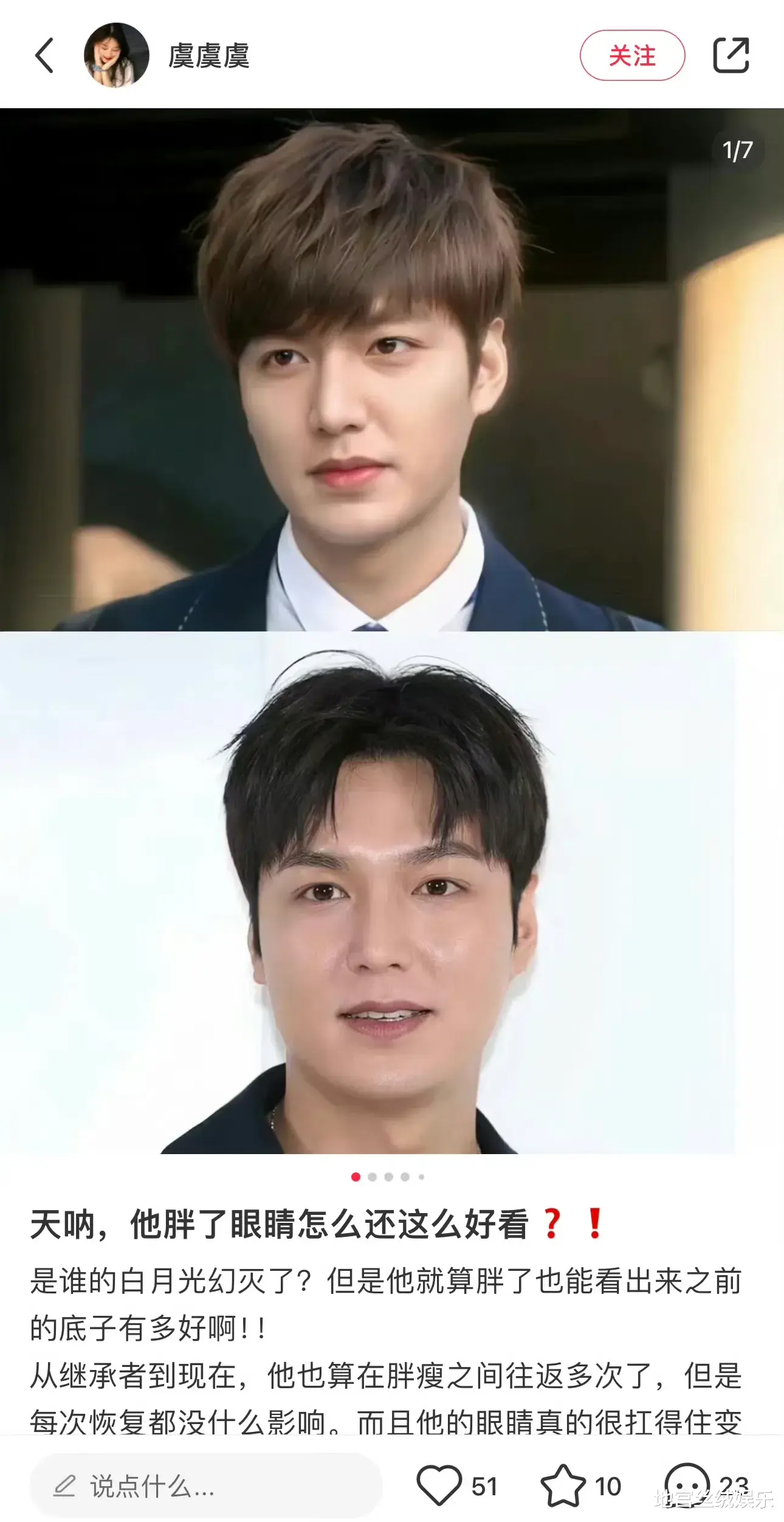 李敏镐肿成馒头,双下巴掉起来,仿佛一个大胖小子,完全认不出了