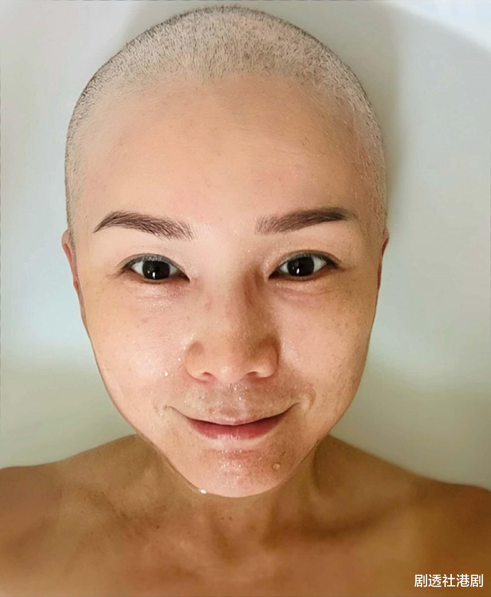 香港知名女星乳癌复发,化疗后掉发剃成光头,已准备好多顶假发