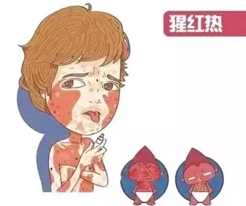 这8种常见春季传染病要注意防范！