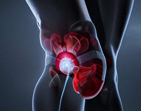 身上这4个部位疼，可能是糖尿病并发症找上门了，别大意，去检查