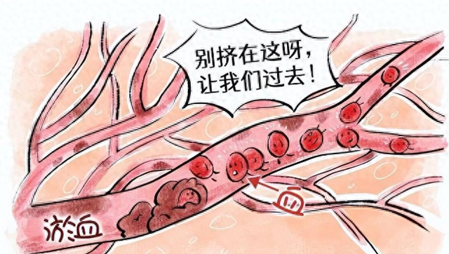 化瘀不在活血,而在补阳,血府逐瘀加一味,阳气充盈,血脉畅行!