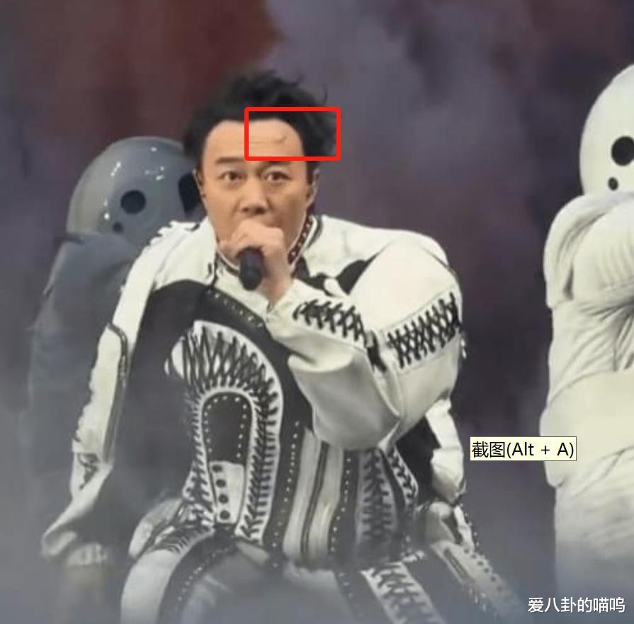 陈奕迅伤口已经拆线,但进食依旧困难,太太发文感谢米其林大厨