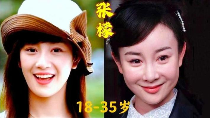 毁在医美的女星：彭丹像伏地魔，张檬“人身蛇脸”，王思懿认不出