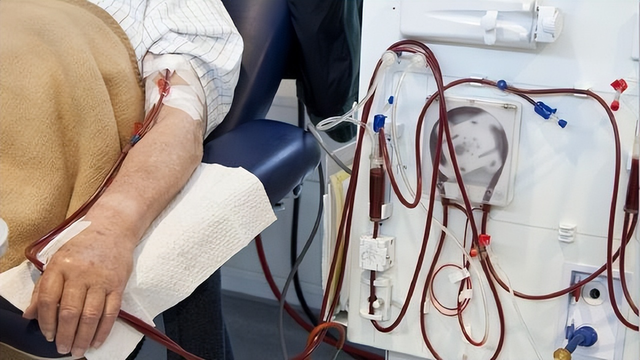 得了尿毒症,看腿就知道?出现这种腿部变化,提醒你需要去医院了