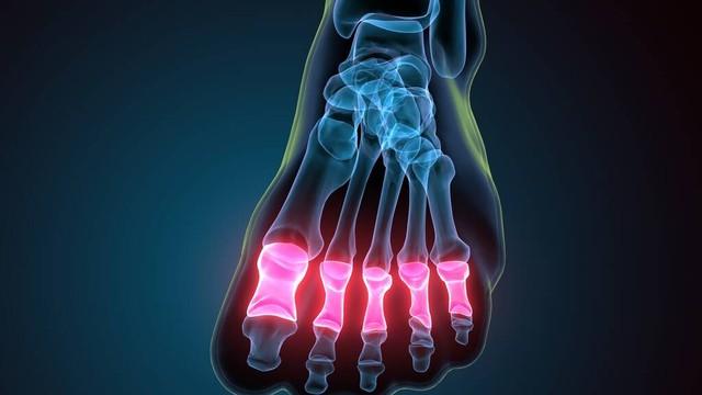 肾衰脚先知,脚上一旦出现4个表现,肾脏或许已被“掏空”