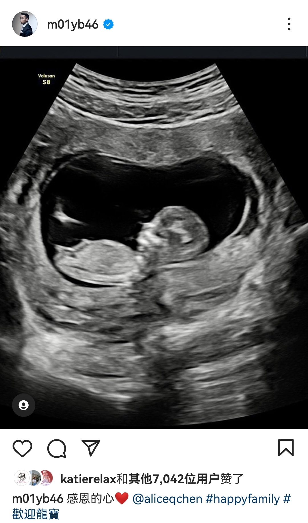 阿娇前夫好福气!办迎婴派对官宣二胎是女儿,与三婚妻子儿女双全