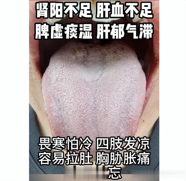 门诊3大典型男科案例——阳虚，湿热下注，中途疲软，时间短