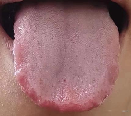 海绵体能不能二次发育?中医直接告诉你答案