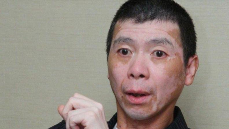 冯小刚一家晒照庆生，18岁养女露面容貌端庄，白癜风治愈后成“白人”