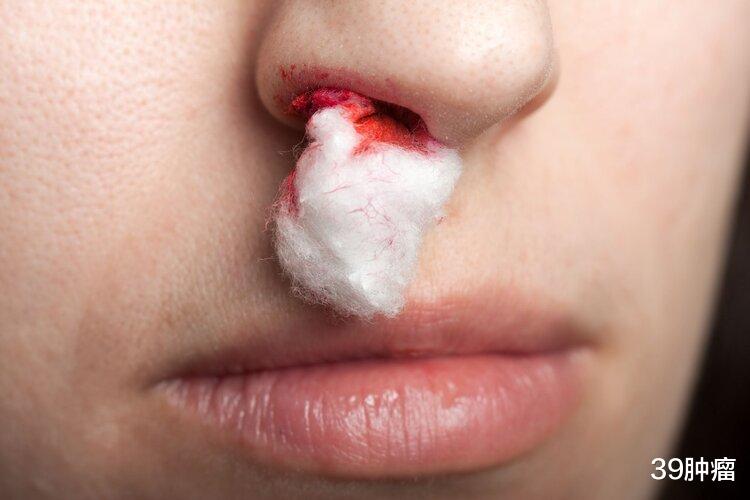 你以为的“上火”，可能是癌症预警，出现5种症状，不要总忽略