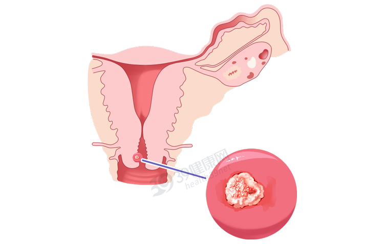 体内有湿气，舌头先知道？身上出现这5种变化，说明你湿气太重了