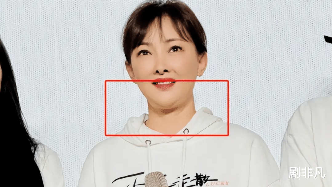 52岁牛莉医美过度认不出!皮肤白嫩没皱纹脸僵硬,和之前判若两人