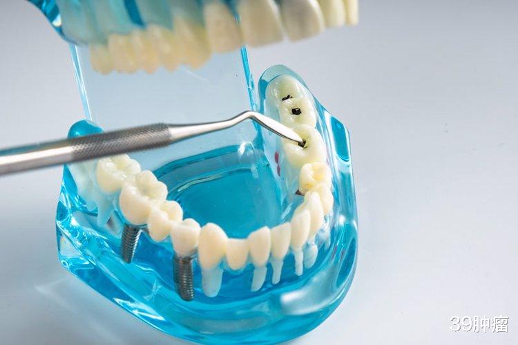 掉牙和寿命有关？60岁后，牙齿剩多少颗才正常？看看你达标了没