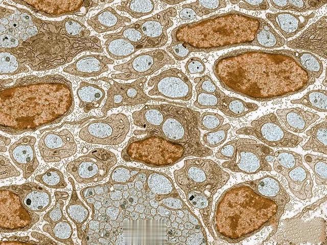 夏天舍不得开空调?有研究表明:温度调低,将抑制多种癌症生长