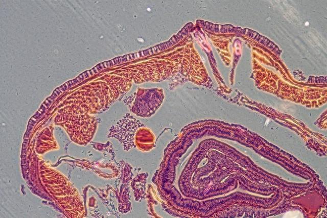 俗话说：“一屁千付药”，常放屁的人和不放屁的人，哪个更健康？