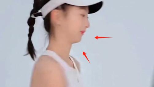 田亮女儿模样大变？16岁森蝶下巴后缩严重，被指腺样体面容，太影响颜值了