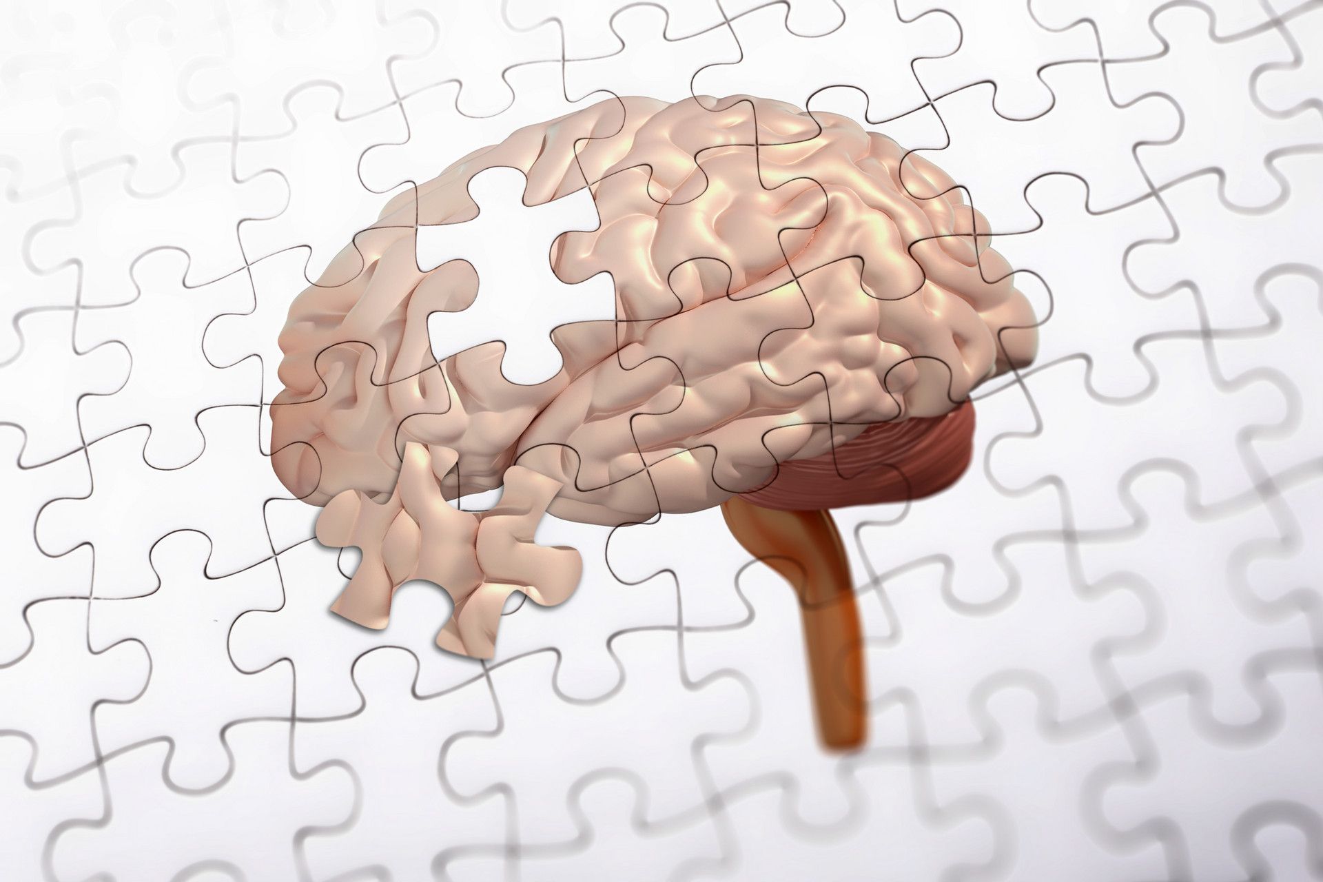 从无症状到有症状，AD患者的生理病理有哪些变化？