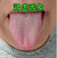 教你三味药，变成真男人