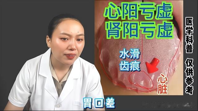 齿痕舌太严重了，都伤及心阳了，只用健脾祛湿的药，怕是没用