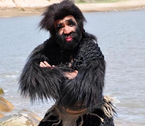 当年轰动一时的“毛孩”：42岁娶90后小娇妻，生一子有无遗传？