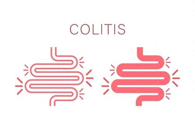 肠胃胀气坐立不安!老是胀气的你的不如试试这些方法!