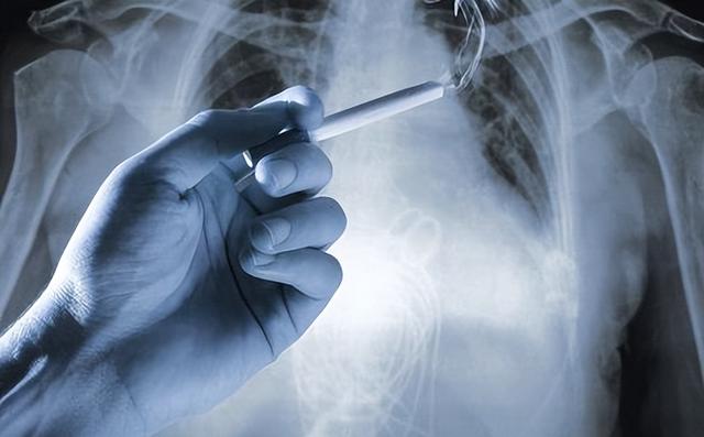 戒烟戒出一身病？可能突发心梗、脑梗？60岁以后戒烟到底好不好？