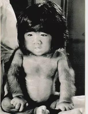 当年轰动一时的“毛孩”：42岁娶90后小娇妻，生一子有无遗传？