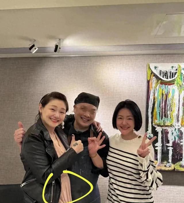 大S生前未P图几张照片流出,面颊浮肿眼睁不开,腰腹部隆起身体